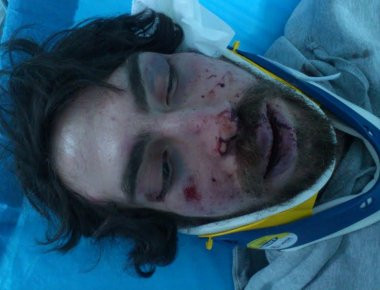 Θύμα άγριου ξυλοδαρμού έπεσε 20χρονος φοιτητής από κουκουλοφόρους στην περιοχή των Ελληνορώσων (φωτό)